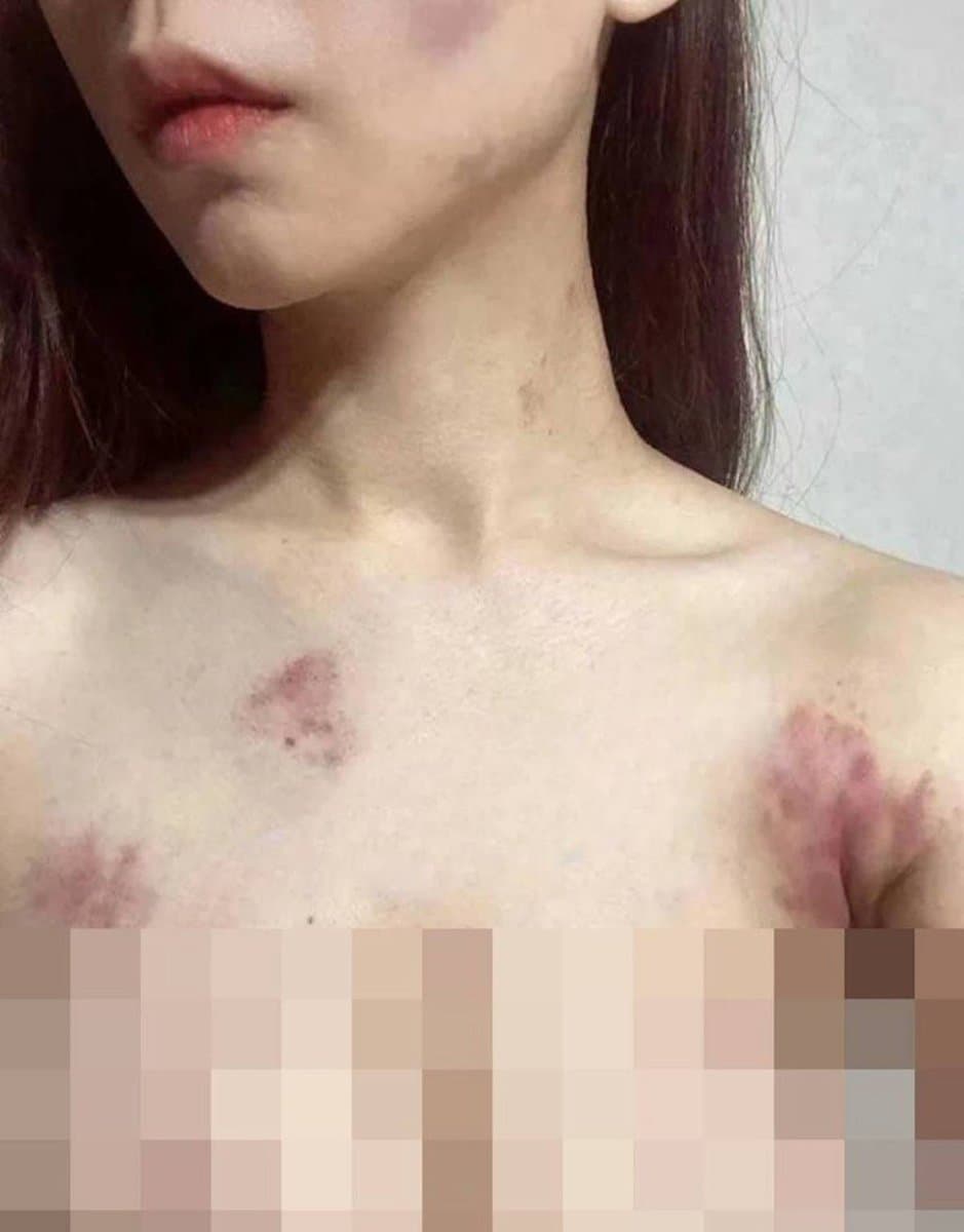 拥有700多万粉丝的世界小姐雅典娜Liya遇害事件破案了,她被闺蜜骗去菲律宾,歹徒向她家里索要80万美元后,将她残忍杀害,美好的人生刚刚开始就结束了(图片 4…